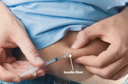 Image of Insulin Shot