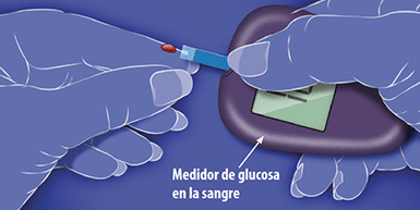 Image of Blood Glucose Meter