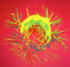 Two Drugs and One Target: Women with HER2+ Breast Cancer