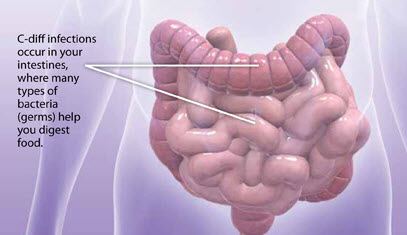 graphic of intestines
