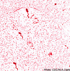 Vibrio cholerae. Leifson flagella stain (digitally colorized).
