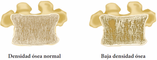 Image of Bone Density