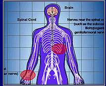 A human silhouette showing pain centers in the chest area and wrist