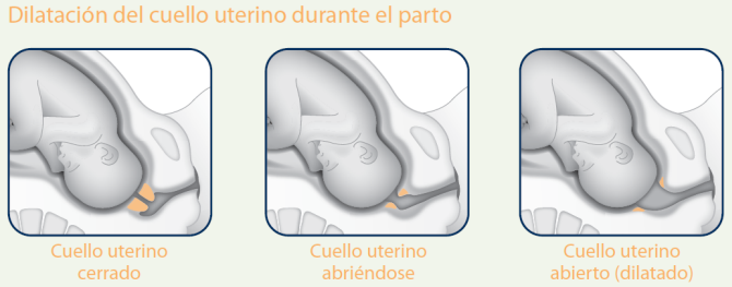 Dilatación del cuello uterino durante el parto