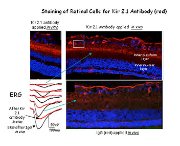 Staining of Retinal Cells for Kir 2.1 Antibody (red)