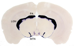 Coronal section through the brain of a Brn3aCKOAP/+; Pax6 :Cre mouse.  Retinorecipient areas receiving projections from RGCs expressing Brn3a are labeled in purple, and include the Medial Terminal Nucleus (MTN) of the Accessory Optic System, the Lateral Geniculate Complex (LGN) and the Pretectal Area (PA).