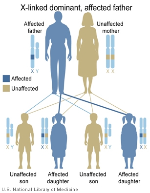 In this example, a man with an X-linked dominant condition has two affected daughters and two unaffected sons.