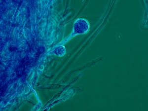 micrograph of fungus species found in Joplin, MO