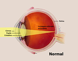 Normal Eye Vision