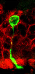 This image shows a transplanted human ES cell in the mouse retina.