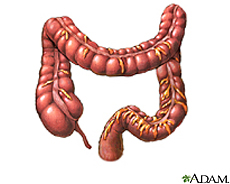 Illustration of the large intestine