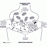 Figure 7 When cocaine enters the brain, it blocks the dopamine transporter from pumping dopamine back into the transmitting neuron, flooding the synapse with dopamine. This intensifies and prolongs the stimulation of receiving neurons in the brain's pleasure circuits, causing a cocaine 