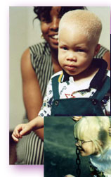 Upper left of a collage - an african american mother with her toddler son who has albinism and the face of a pre-school girl wit albinism on a swing