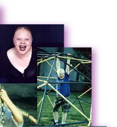 Upper right of a collage - an african american woman with albinism a pre-teen boy with albinism on a jungle gym
