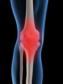 Illustratoin of a leg at the knee, the joining of the bones is red to imply pain.