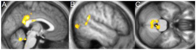 A diagram illustrating the effects of meditation in the brain.