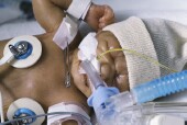 Oxygen Treatment May Improve the Odds for Extreme Preemies
