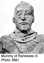 Egyptian Pharaoh's Throat Was Slashed During Coup, Research Suggests