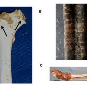 Animal scavenging marks on bones from dead bodies