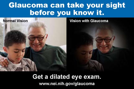 Glaucoma E-card