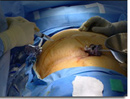 Photo of surgical procedure