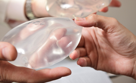 5 Things to Know About Breast Implants - (TOPIC FEATURE)