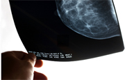 Study: Digital Beats Film Mammography at Spotting Breast Cancer