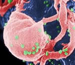 Scanning electron microscope image of HIV virons on CD4 lymphocytes.