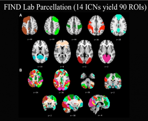 PET scans - FIND Lab Parcellation