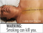 Text: WARNING: Smoking can kill you. Image: Deceased man with surgical staples going down his chest. Cessation Resource: 1-800-QUIT-NOW Copyright: U.S. HHS