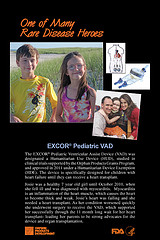 EXCOR® Pediatric VAD/Josie Basta