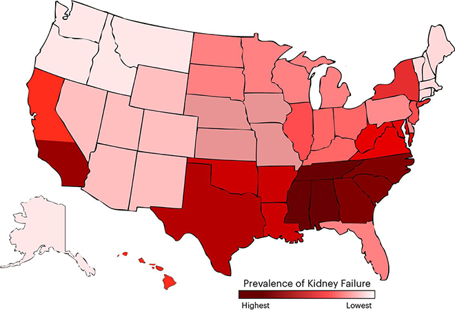 The south has the highest rates of kidney disease in the U.S. Where does your state fall on the list?