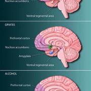 parts of the brain impacted by drugs 