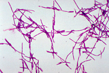 Microscope image showing chains of long, thin bacterial cells.