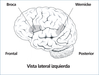 Partes del cerebro afectadas por la afasia