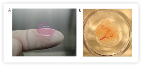 A: To the naked eye, a HEAL looks like a pink contact lens. Approximately 4/5 of an inch in diameter, the implant comprises half a million liver cells. B: Growth of blood vessels (red) enables implanted HEALs to grow and function in the mouse. This miniature human liver was removed from a HEAL-humanized mouse.