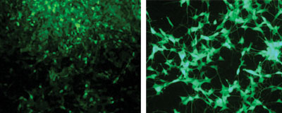 Neuroblastoma cells labeled with green fluorescent protein, before (left panel) and after (right panel) treatment with retinoic acid. Retinoic acid treatment arrests tumor cell growth and induces differentiation.