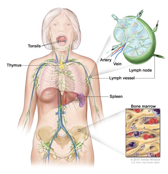 Lymph system; drawing shows the lymph vessels and lymph organs including the lymph nodes, tonsils, thymus, spleen, and bone marrow.  One inset shows the inside structure of a lymph node and the attached lymph vessels with arrows showing how the lymph (clear fluid) moves into and out of the lymph node. Another inset shows a close up of bone marrow with blood cells.