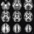 Series of MRI Scans of the Brain