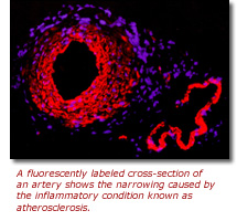 A fluorescently labeled cross-section of an artery shows the narrowing caused by the inflammatory condition known as atherosclerosis.