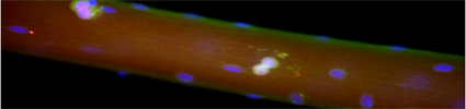 Two  skeletal muscle stem cells ( doublets in red and magenta), associated with a muscle fiber,  during cell division