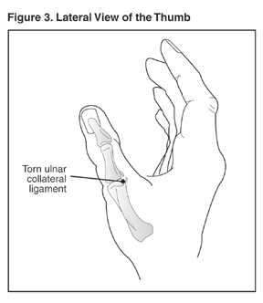 Illustration of a Lateral View of the Thumb