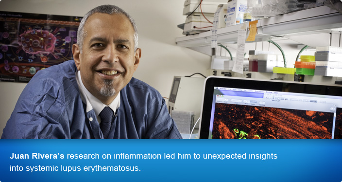 Juan Rivera's research on inflammation led him to unexpected insights into systemic lupus erythematosus.