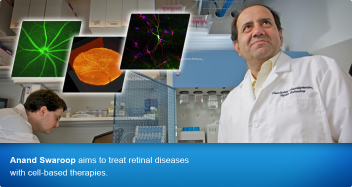 Anand Swaroop aims to treat retinal diseases with cell-based therapies.