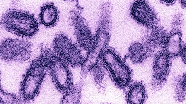 Spanish Flu Virus