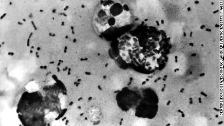 UNDATED PHOTO:  A bubonic plague smear, prepared from a lymph removed from an adenopathic lymph node, or bubo, of a plague patient, demonstrates the presence of the Yersinia pestis bacteria that causes the plague in this undated photo. The FBI has confirmed that about 30 vials that may contain bacteria that could cause bubonic or pneumonic plague have gone missing, then found, from the Health Sciences Center at Texas Tech University January 15, 2003 in Lubbock, Texas. The plague, considered a likely bioterror agent since it&#39;s easy to make, is easily treatable with antibiotics if diagnosed early and properly.  (Photo by Centers for Disease Control and Prevention/Getty Images)