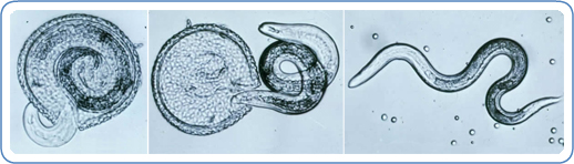 Various stages of Toxocara canis larva hatching.