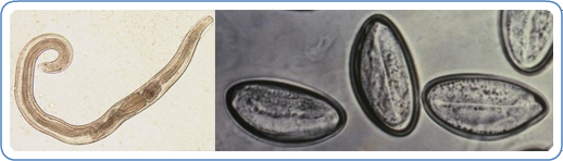 Left: Adult male of E. vermicularis from a formalin-ethyl acetate (FEA) concentrated stool smear. The worm measured 1.4 mm in length. Image courtesy of Centre for Tropical Medicine and Imported Infectious Diseases. Right: Image of the eggs of the human parasite Enterobius vermicularis, or 'human pinworm', captured on cellulose tape under significant magnification.