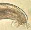Parasitic meningitis